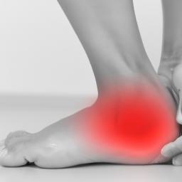Plantar Fasciitis: A Common Injury in Dartford FC Explained