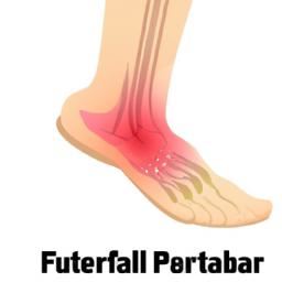 Exploring the Connection Between Dartford FC and Plantar Fasciitis
